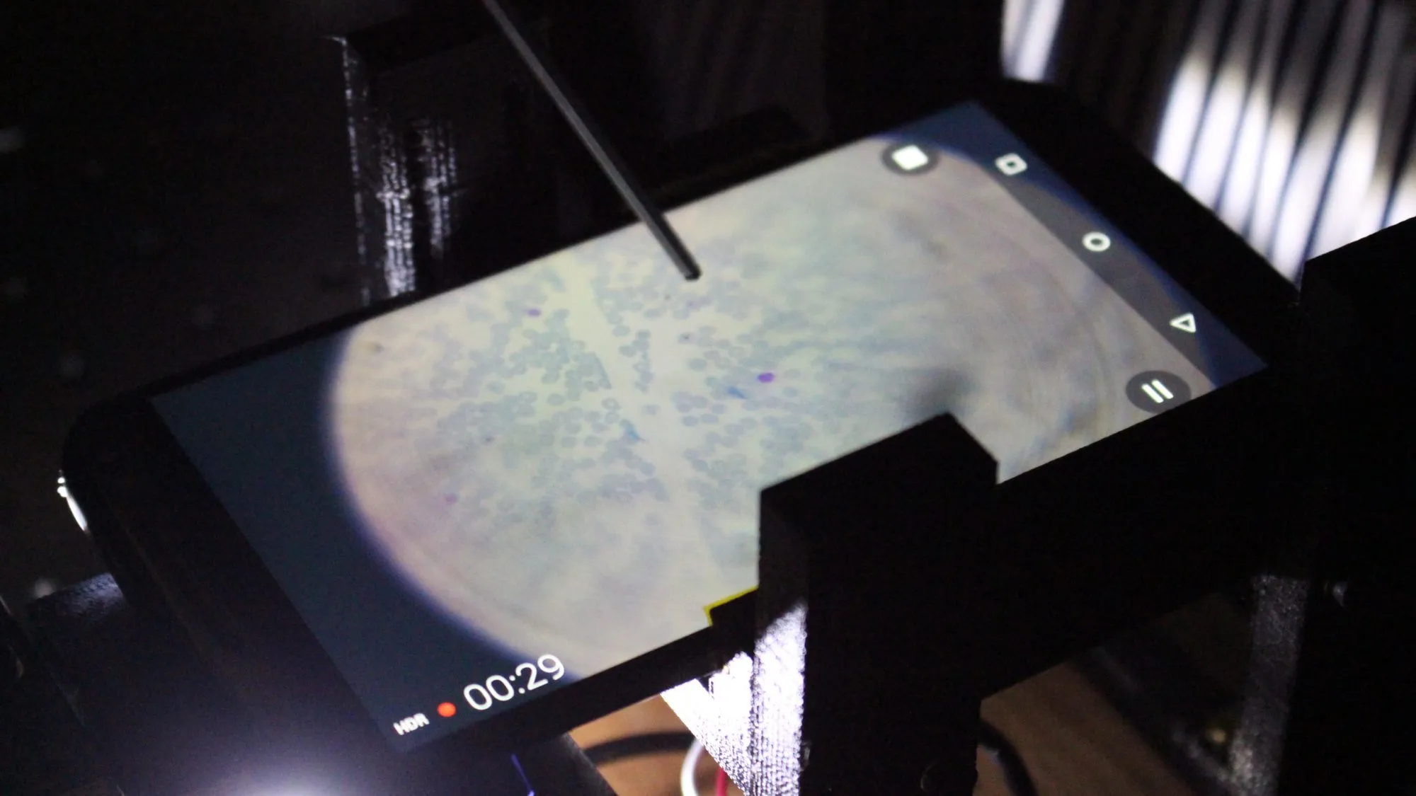 A blood smear on the phone screen, mid capture.